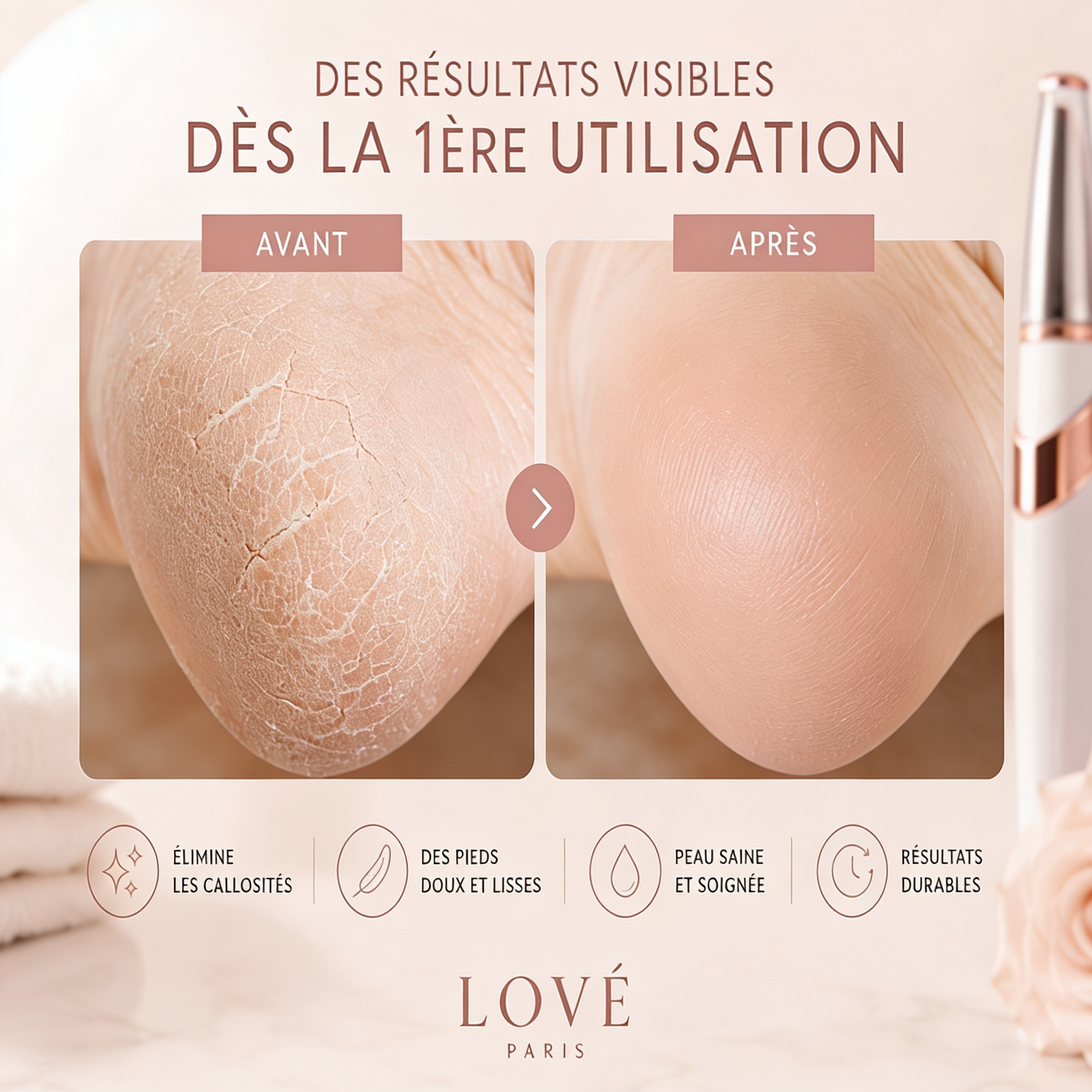 Lové Silk Pro 2026™