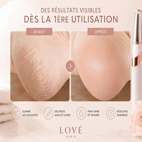 Lové Silk Pro 2026™
